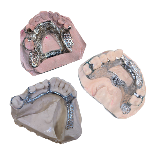 Digital Design Case B&T