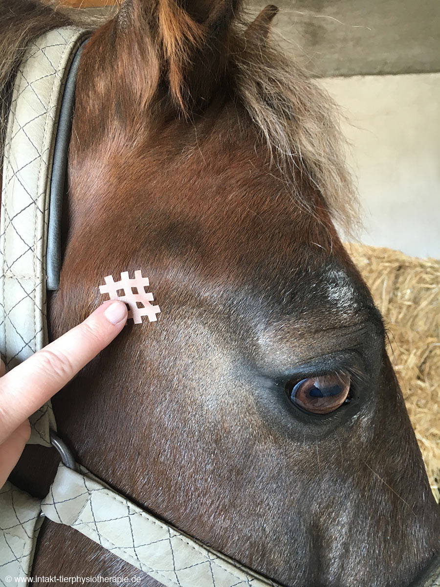 Crosstape-Kiefergelenk