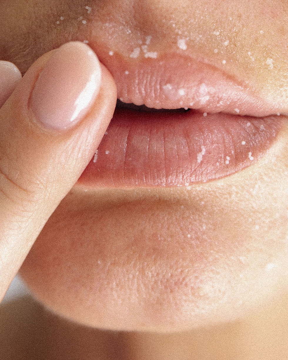 1-dermal-filler-ottawa (1).jpg