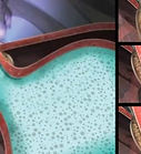 Dr. Guilherme Antoniette - Clinica Endonette - Terapia Stretta