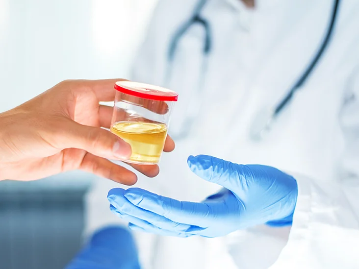 Urine_Concentration_Test-732x549-thumbnail.webp