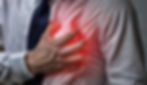 INFARTO
