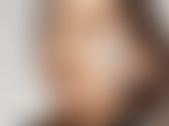 ELOLIFT : Pourquoi les fils de collagène et de soie sont la solution anti-âge longue durée idéale ?