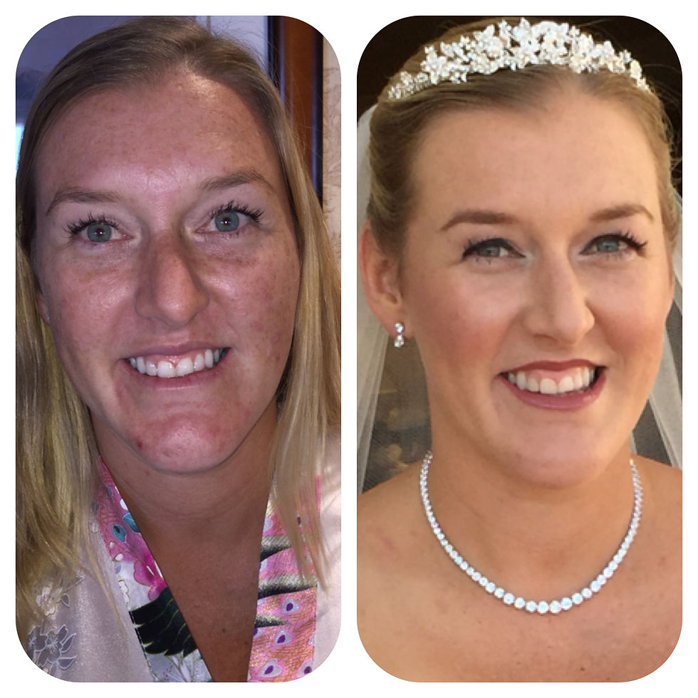 BEFORE & AFTER Face Forward Bridal United States