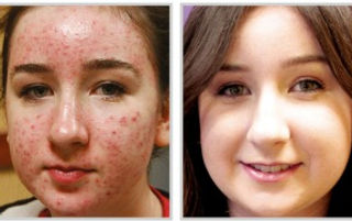 before after image20_edited.jpg