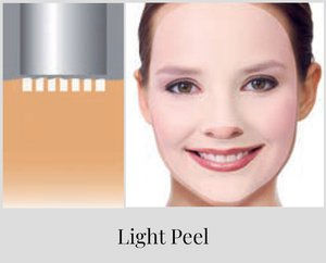 Fotona 4D Treatment for Skin Tightness Step 4 Eden Aesthetics Dubai