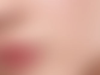 Lip Injection 101: What To Expect When Receiving Lip Filler