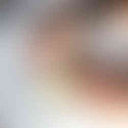 another piece of dough to secure the egg