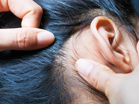 La higiene en casa, vital para evitar brote de piojos: IMSS