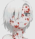 ニキビ