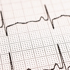 Dr Rahul Mukherjee is an expert at ECG analysis