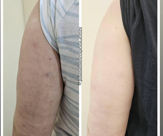 LIPOENZIMAS (2).jpg