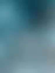 How AI is Revolutionising Preventive Healthcare