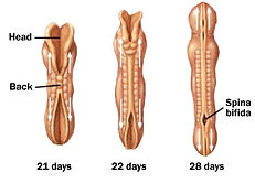 acrania, anencephaly, anencephaly facts, anencephaly awareness, acrania facts, acrania awareness, anencephaly family support, acrania family support, anencephaly information, acrania information, Duke Research, Anencephaly research, acrania research, luca hill, st.peters missouri, st.peters mo,