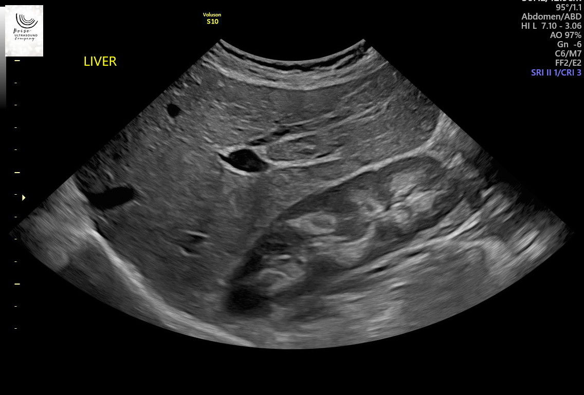 Boise Ultrasound Company