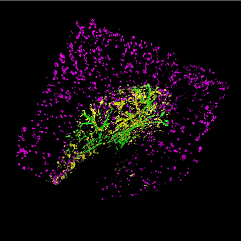 Bone printed + vessels.png