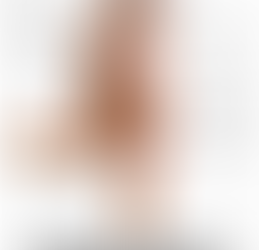 Ilio-Tibial Band Syndrome: A Common Cause of Lateral Knee Pain