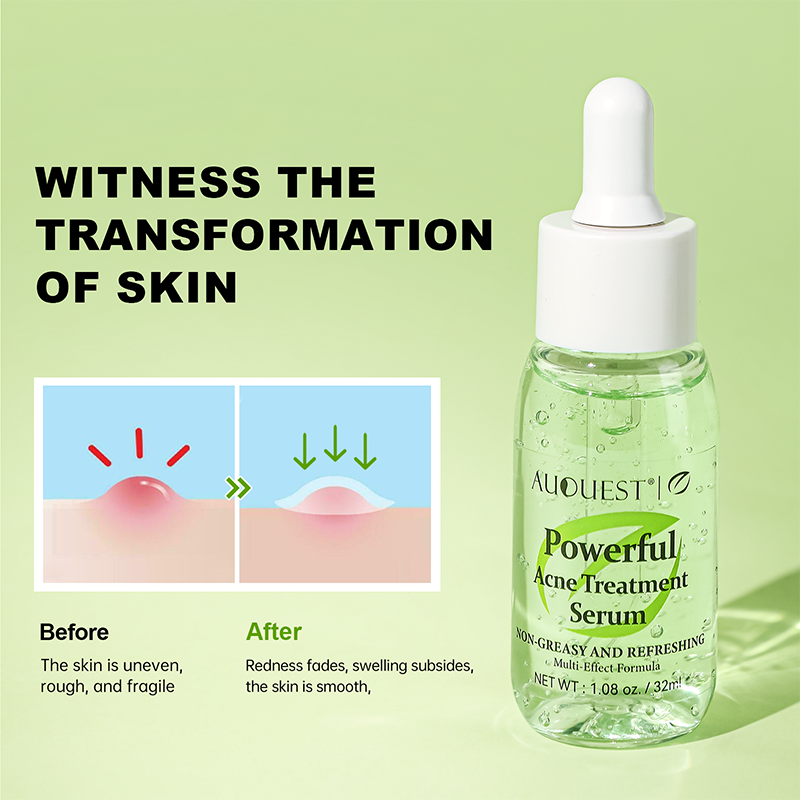 Thumbnail: AUQUEST Salicylic Acid Acne Treatment Face Serum Oil Control Herbal Fades Acne M