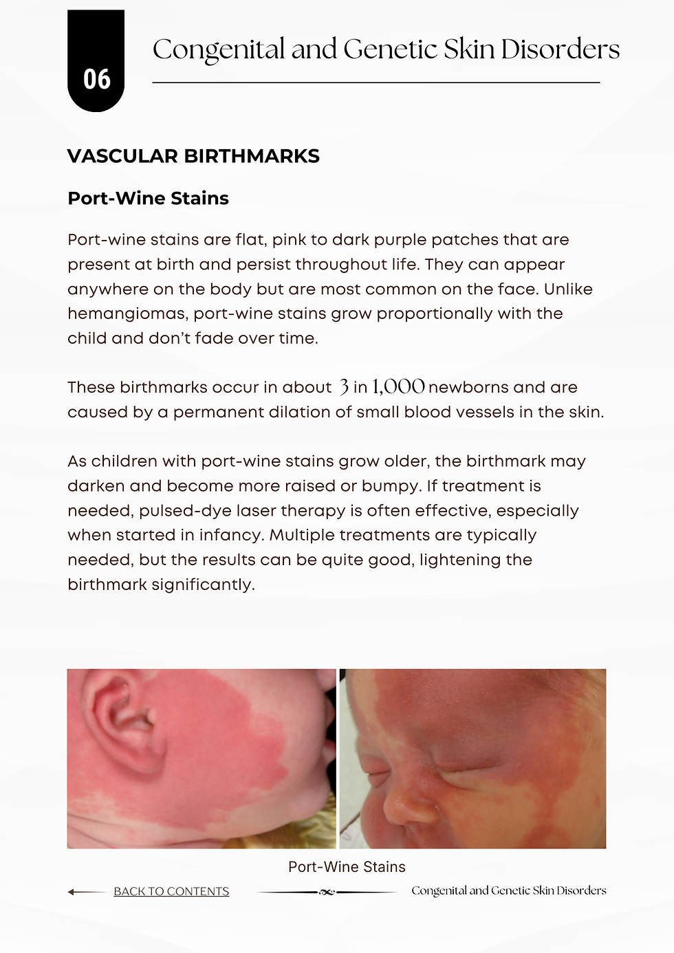 Thumbnail: Understanding and Managing Baby's Skin inner page