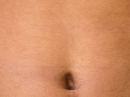 The Science of Smooth Skin: How Inkless Stretch Mark Revision Works