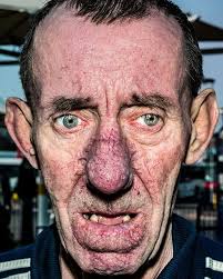 Bruce Gilden – Retratos callejeros extremos. Tiene reproches frecuentes por Fotografiar sin consentimiento inmediato. Famoso por usar flash a centímetros del rostro de desconocidos en la calle. Sus series en Nueva York y Londres están en el centro del debate de acoso fotográfico y ética del retrato callejero.