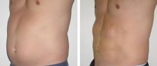 pancia uomo cellulite.jpg