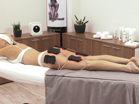 Come Contrastare gli Inestetismi della Cellulite a Padova: La Verità sui Tessuti Infiammati