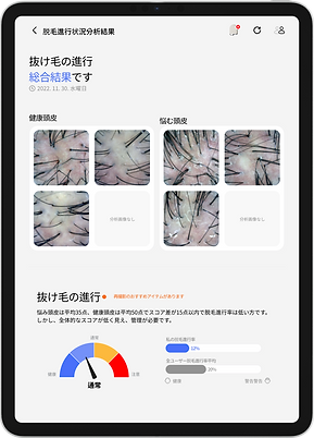 タブレットに脱毛進行分析結果が表示されている画像