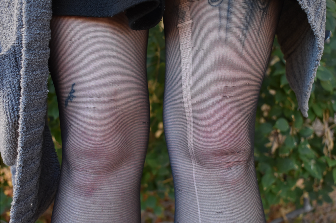 A woman's knees standing infant of bush wearing ripped tights with tattoos on her legs