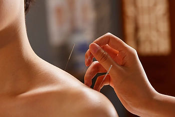 holistic health treatments
