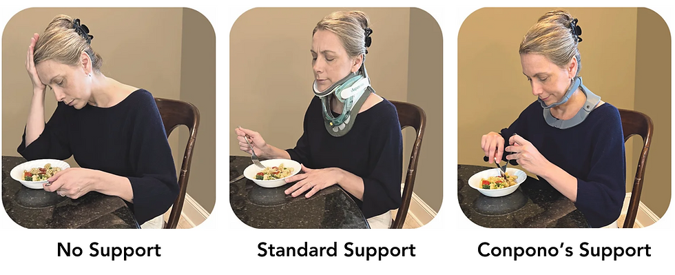 Eating with dropped head syndrome