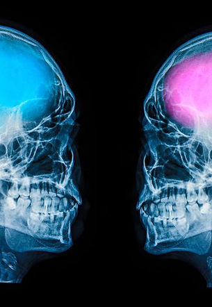 GenderedBrains_APStock-1024x576.jpg