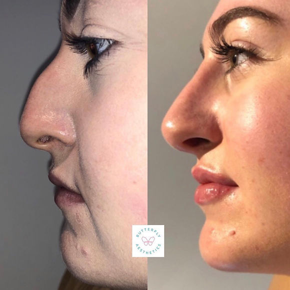 Pink Oyster Mushrooms