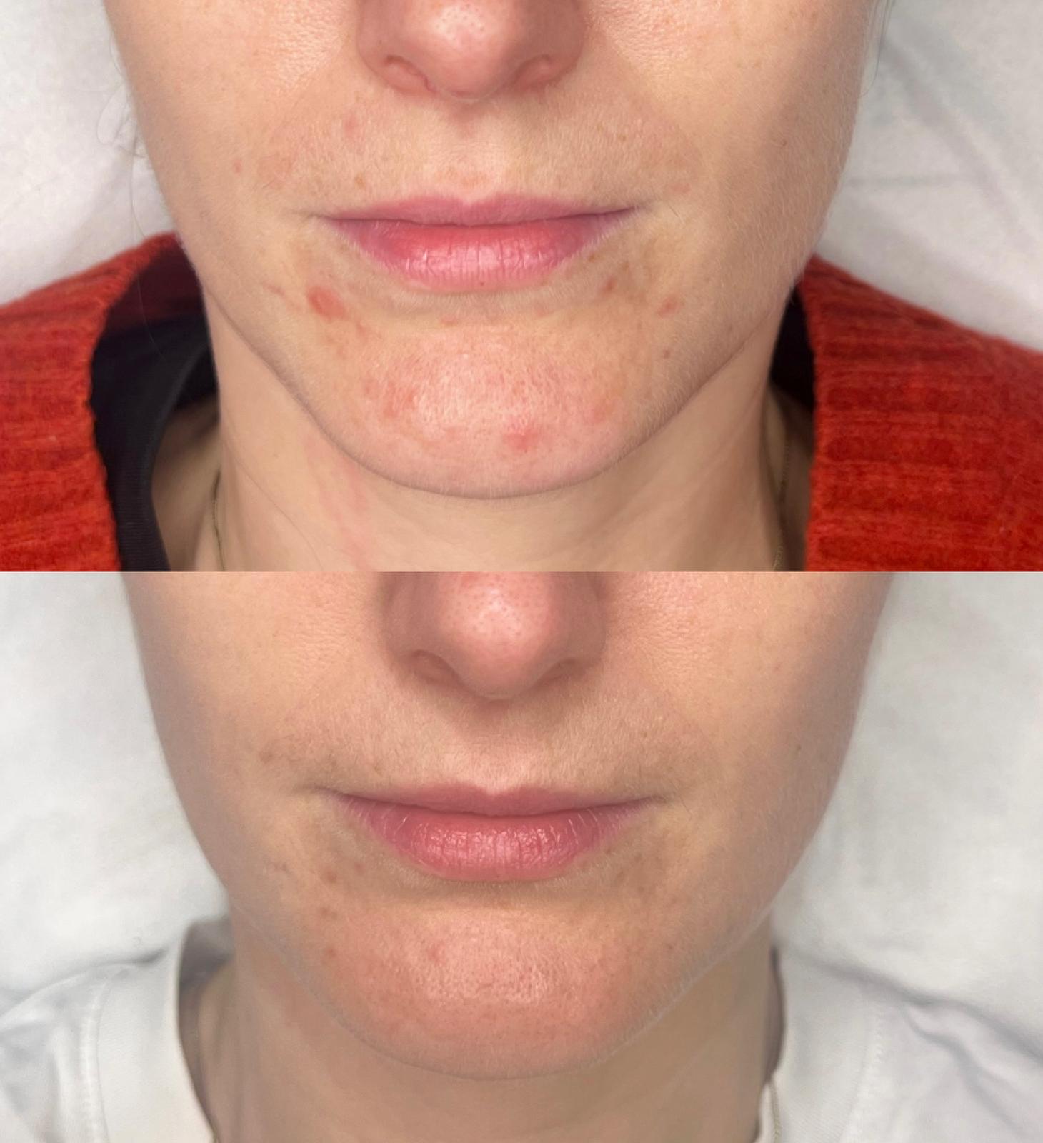 Aesthetic consultation at JB Aesthetics Marylebone