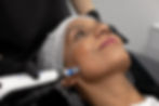 butterfly aesthetics, dermal fillers, anti-wrinkle, hydrafacial, skin care, microneedling, beauty treatments