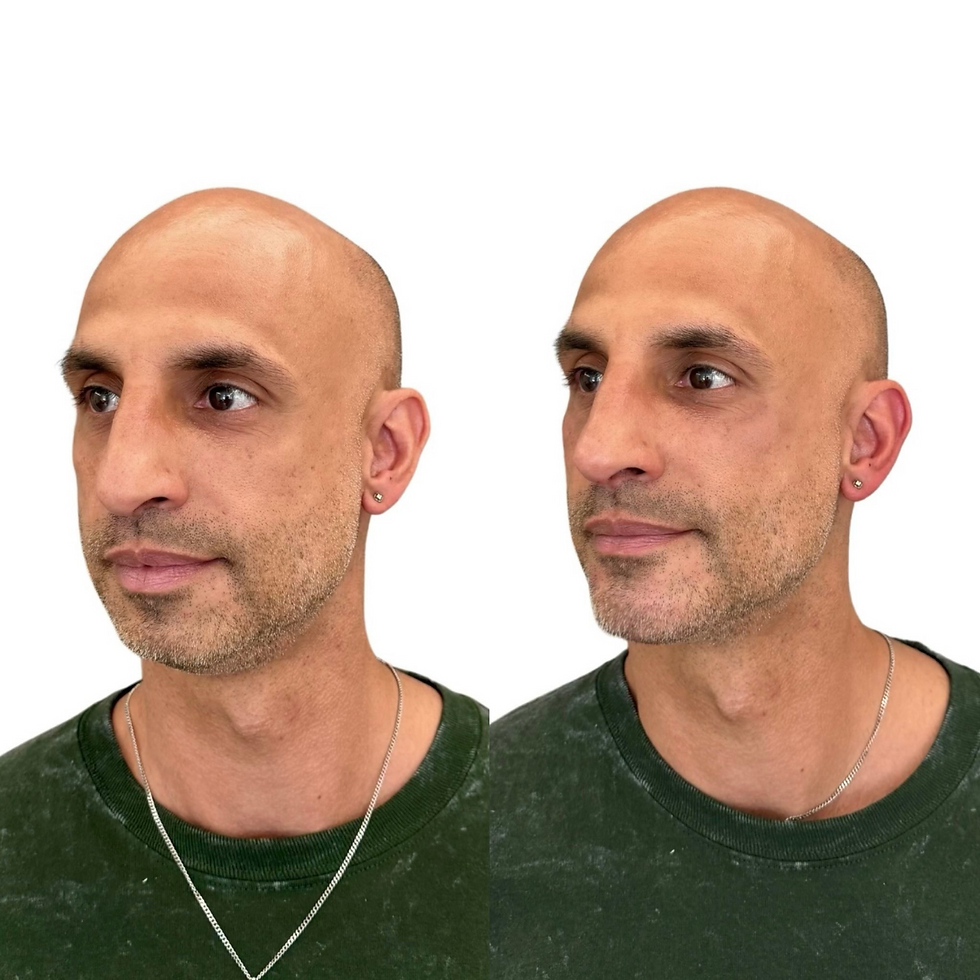 Injectable aesthetic treatment Marylebone clinic