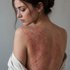 The Gut–Skin Connection