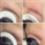 Tattoo laseren verwijderen