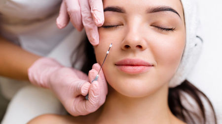 Passo a passo dos fios de sustentação