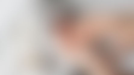 Rejuvenescimento das mãos: o protocolo completo que trata volume, colágeno e qualidade da pele em uma única sessão