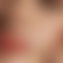 NCTF: tratamento que nutre a pele de dentro para fora, sem alterar o rosto