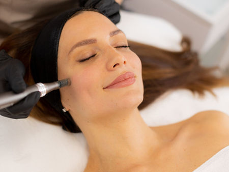 O que acontece sob a pele após o microagulhamento