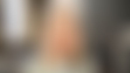 Sustentação da face: por que não é só sobre preenchimento