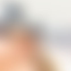 Mitos e verdades sobre flacidez facial