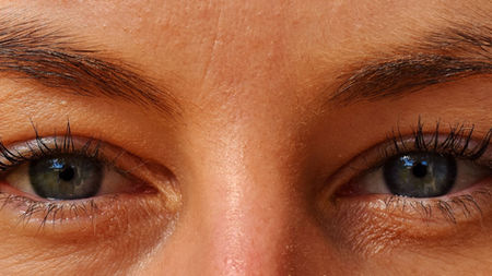 Plasmage: blefaroplastia sem cortes para rejuvenescer o olhar