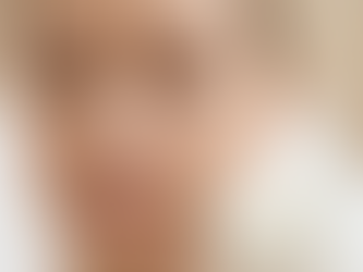 O que esperar depois de um peeling? O guia completo do pós-procedimento para uma recuperação perfeita.