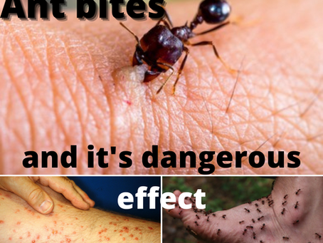 KARINCA ISIRIĞI: NEDİR & NE İYİ GELİR?