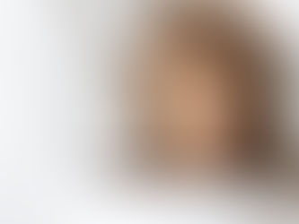 Does Bruxism (Teeth Grinding) Disqualify You From Getting Dental Implants?