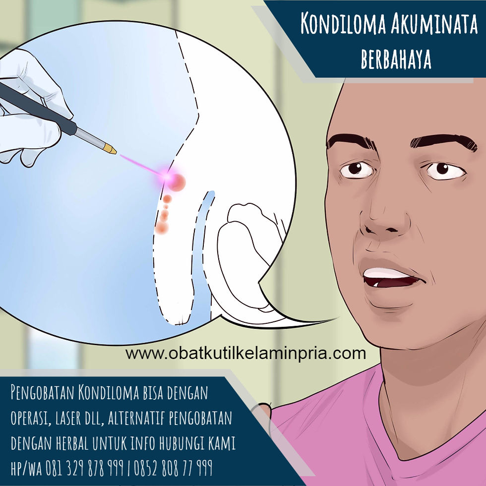 Pengobatan Kutil Kelamin Pada Ibu Hamil