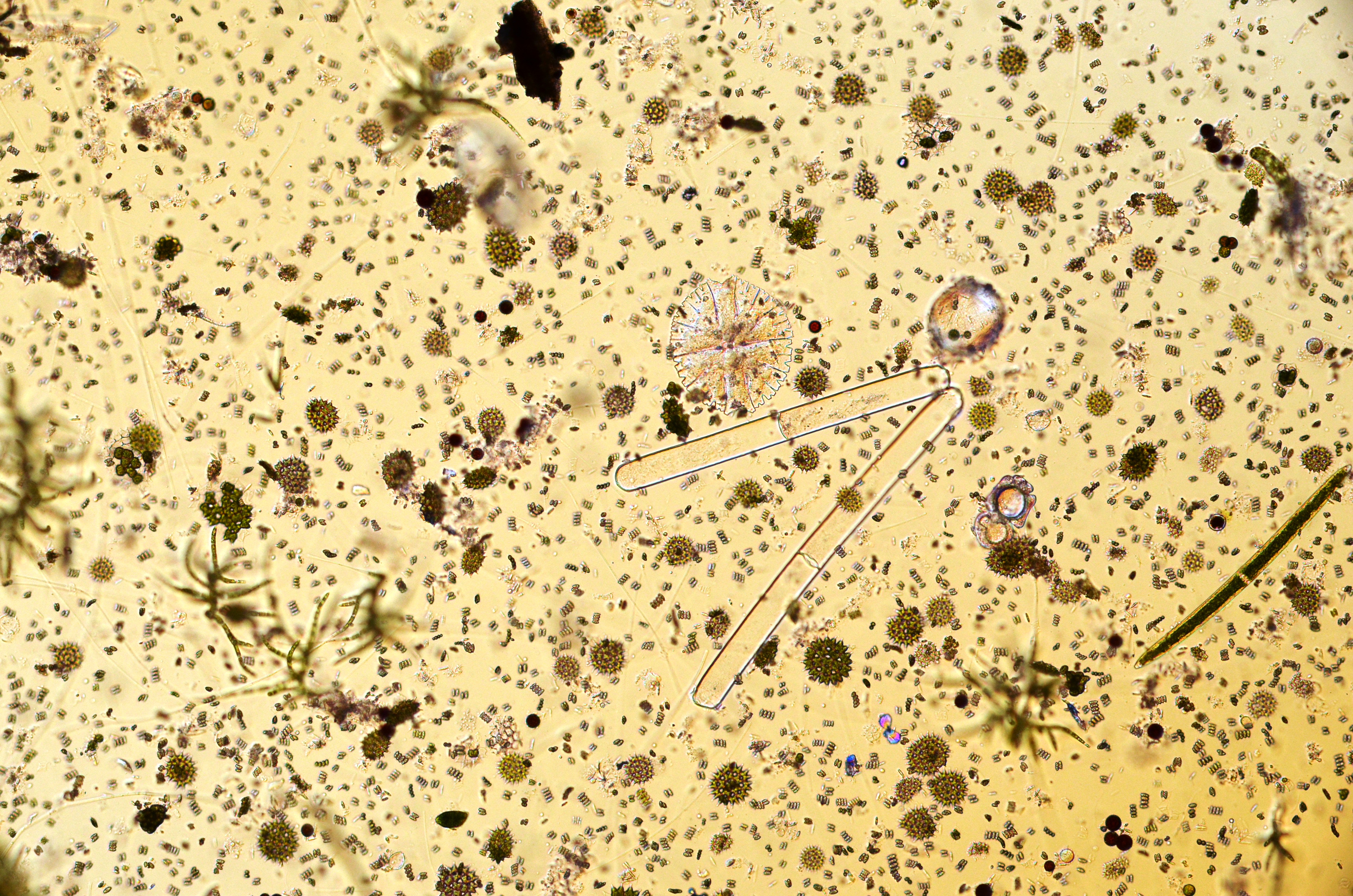 Озерная вода под микроскопом. Вода под микроскопом. Вода через микроскоп. Фазовоконтрастная микроскопия. Вода через микроскоп.